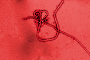 The Ebola Outbreak: Lessons learned